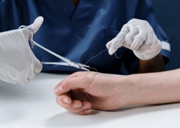 How To Calculate Your Car Accident Personal Injury Claim Damages In Hampton