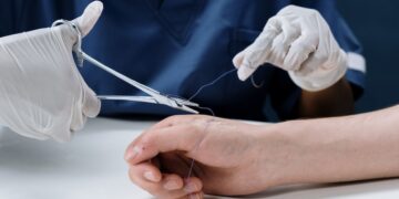 How To Calculate Your Car Accident Personal Injury Claim Damages In Hampton