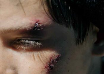 9 Best Ways To Remain Informed About Your Personal Injury Case