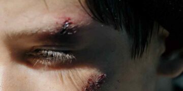 9 Best Ways To Remain Informed About Your Personal Injury Case