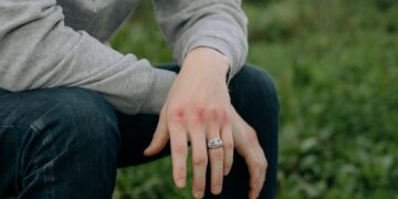 Common Mistakes That Can Reduce Your Personal Injury Compensation—and How to Avoid Them