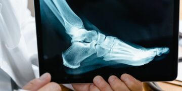 What to Do Immediately After Suffering a Personal Injury in Torrance