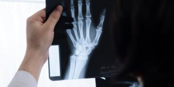 What to Expect When Filing a Personal Injury Claim in Virginia in 2024