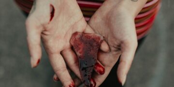 How to Claim Injury Compensation
