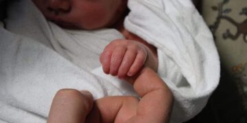 What To Do If Your Baby Suffers A Birth Injury