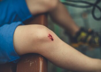 Why Is It Wise to Hire Injury Lawyers for Your Personal Injury Case