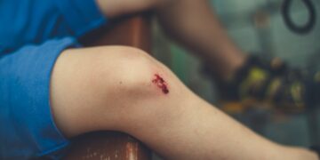 Why Is It Wise to Hire Injury Lawyers for Your Personal Injury Case