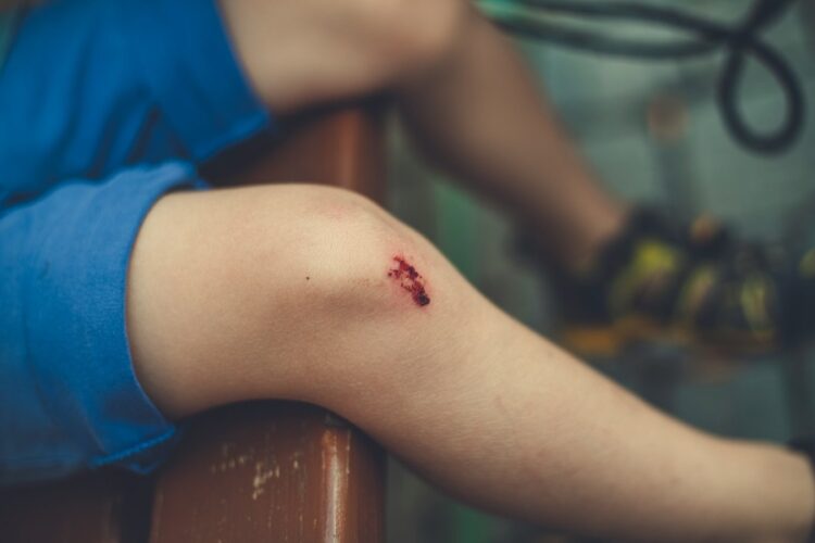 Why Is It Wise to Hire Injury Lawyers for Your Personal Injury Case