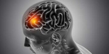 How to get on disability for a traumatic brain injury