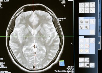 How To Seek Compensation for Brain Injury After an Accident