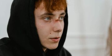 Personal Injury Law Misconceptions