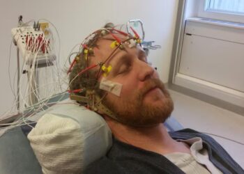 Is It Just Brain Fog