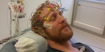 Is It Just Brain Fog