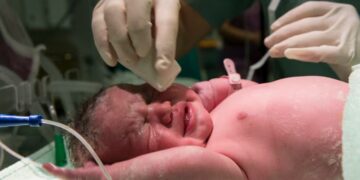 Birth Injury vs. Birth Defect